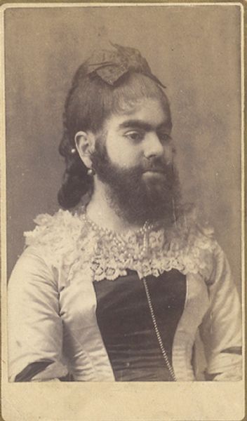 Barnum's Bearded Lady Annie Jones CDV
