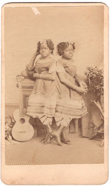 CDV of Conjoined Twins Christine and Millie McCoy